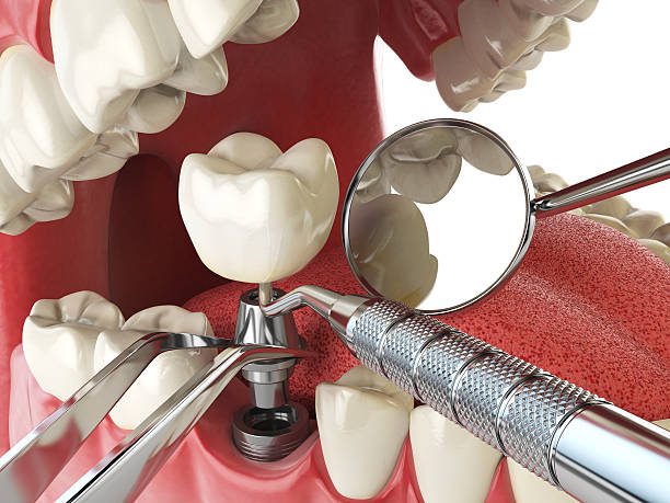 Best Emergency Dentist for Knocked-Out Tooth in Prairie View, TX